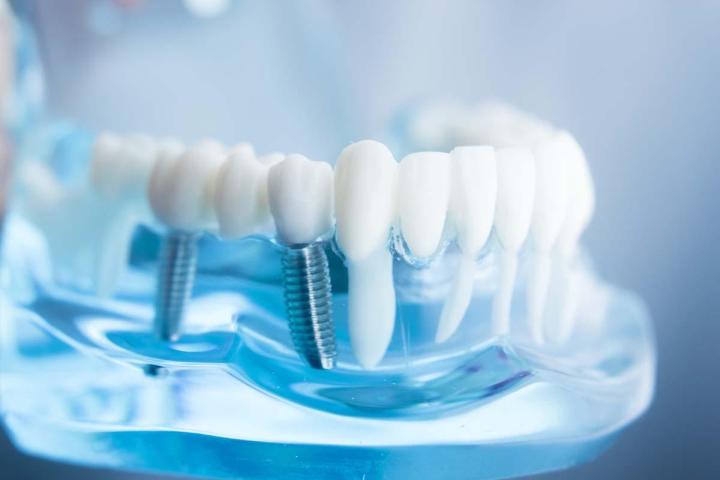 Spécialiste de l’implantologie qui vous garantit conseil et accompagnement